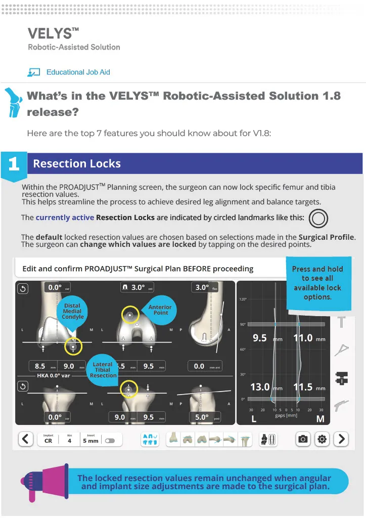 VELYS™ Robotic-Assisted Solution one-sheet, p.1