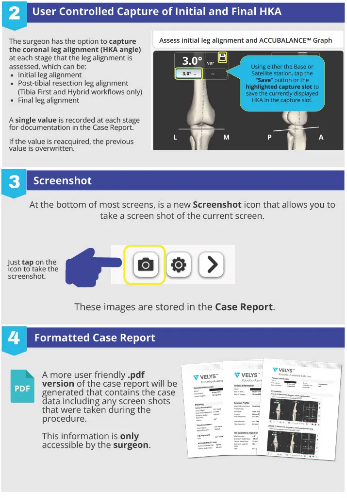 VELYS™ Robotic-Assisted Solution one-sheet, p.2